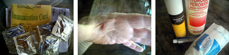 Images of healing hand