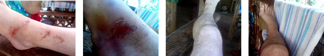 Images of healing sores on leg