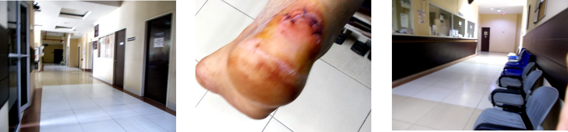 Images of hospital and injured foot