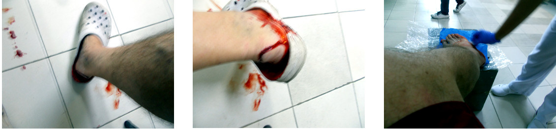 Images of a wounded foot
